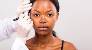 Plastic Surgery Is On The Rise In Africa: 13 Questions To Ask Before Choosing Your Surgeon