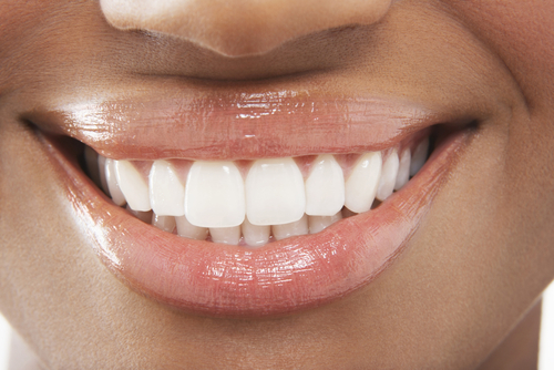 5 Natural Ways To Keep Your Teeth Pearly White