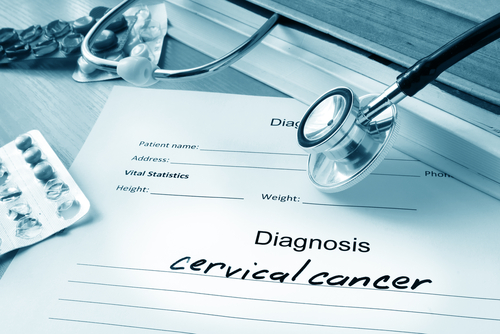 Cervical Cancer And The Nigerian Woman