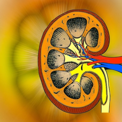 A Successful Kidney Transplant from Pig To Human
