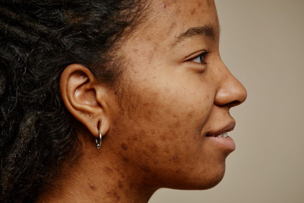 black skin problems