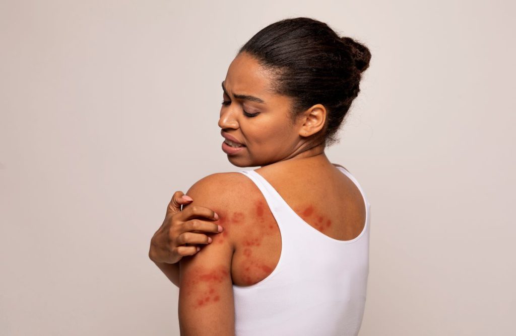 black skin conditions